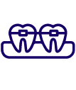 Orthodontic Braces