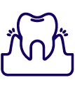 Gum Disease Treatment