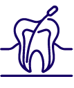 Root Canal Treatment
