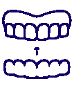 Invisalign
